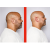 Remington XR8000 Balder™ Head&Beard körkéses borotva Remington XR8000 Balder™ Head&Beard körkéses borotva