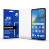 Xprotector Kijelzővédő üvegfólia, 0.33 mm, Huawei P30 Xprotector Kijelzővédő üvegfólia, 0.33 mm, Huawei P30
