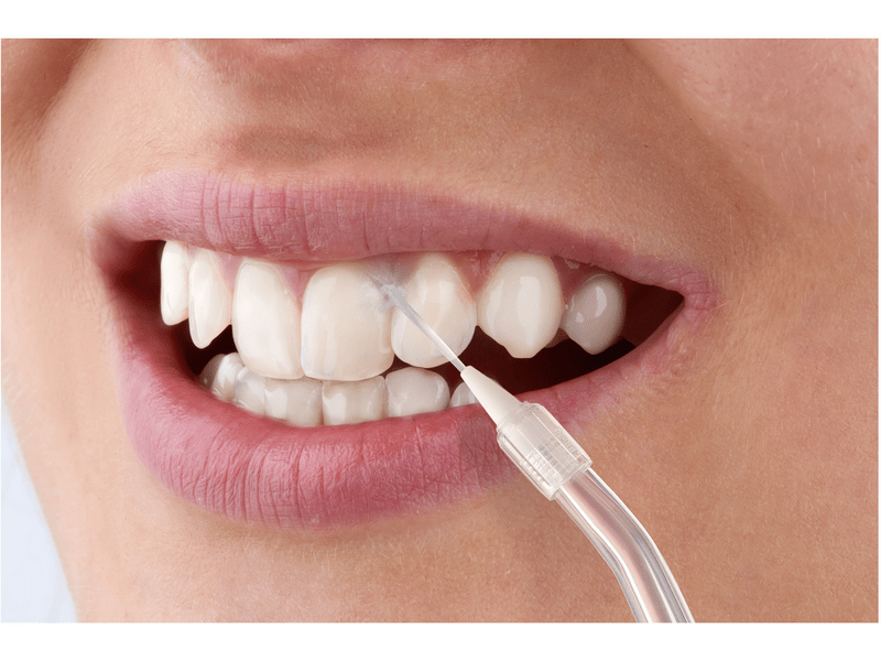 Sencor SOI 1310BL Szájzuhany, kék