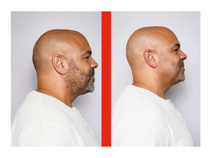 Remington XR8000 Balder™ Head&Beard körkéses borotva