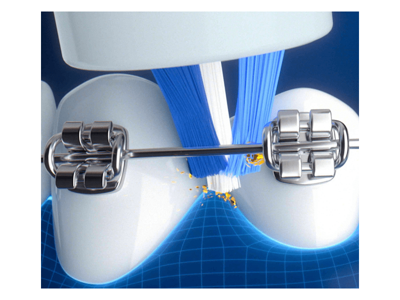 Oral-b iO MyWay Elektromos fogkefe