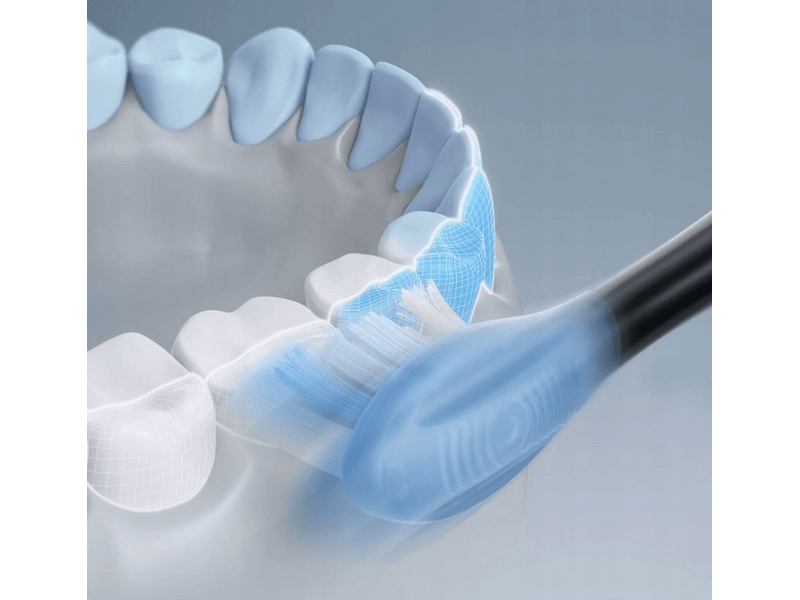 Oclean X Ultra 20 sonična četkica za zube, zelena