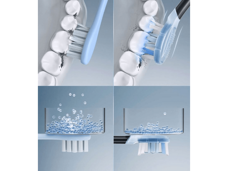 Oclean X Ultra 20 sonična četkica za zube, crna