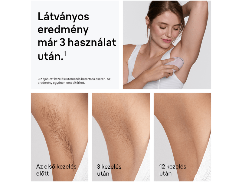 Braun PL1100 Silk Expert IPL Szőrtelenítő, rózsaszín