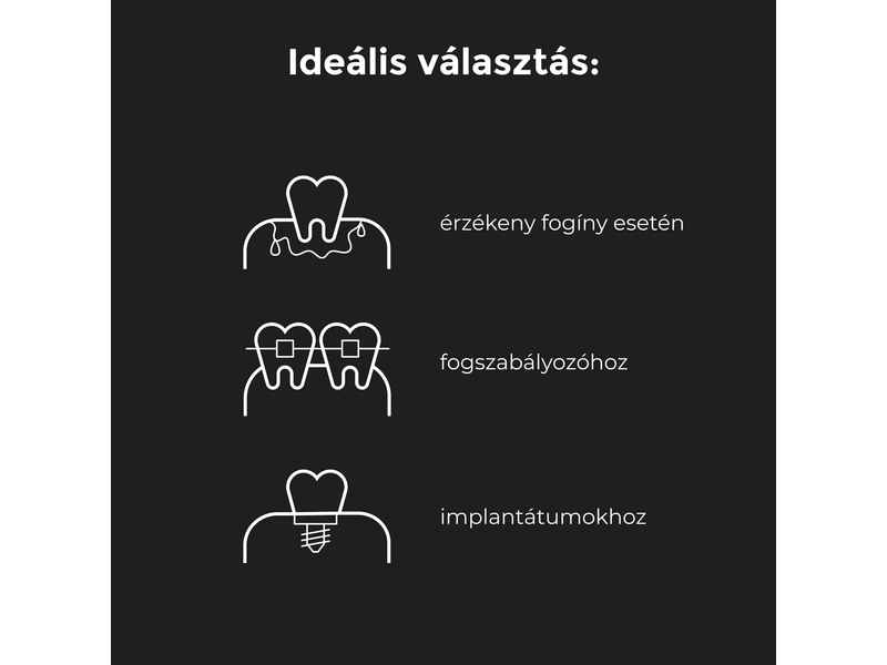 Aeno DB1S električna četkica za zube