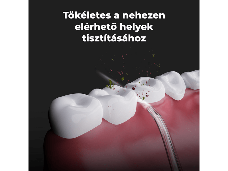 Aeno DI1 Szájzuhany